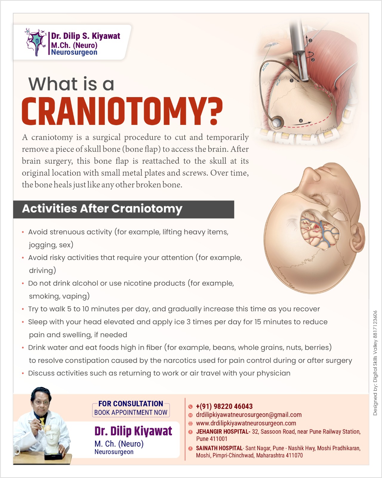 What is a Craniotomy?