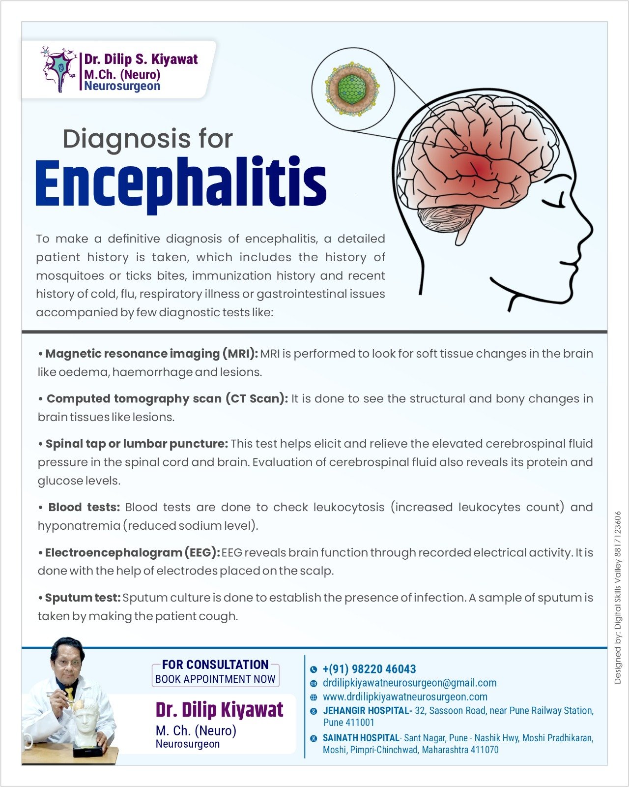 Encephalitis