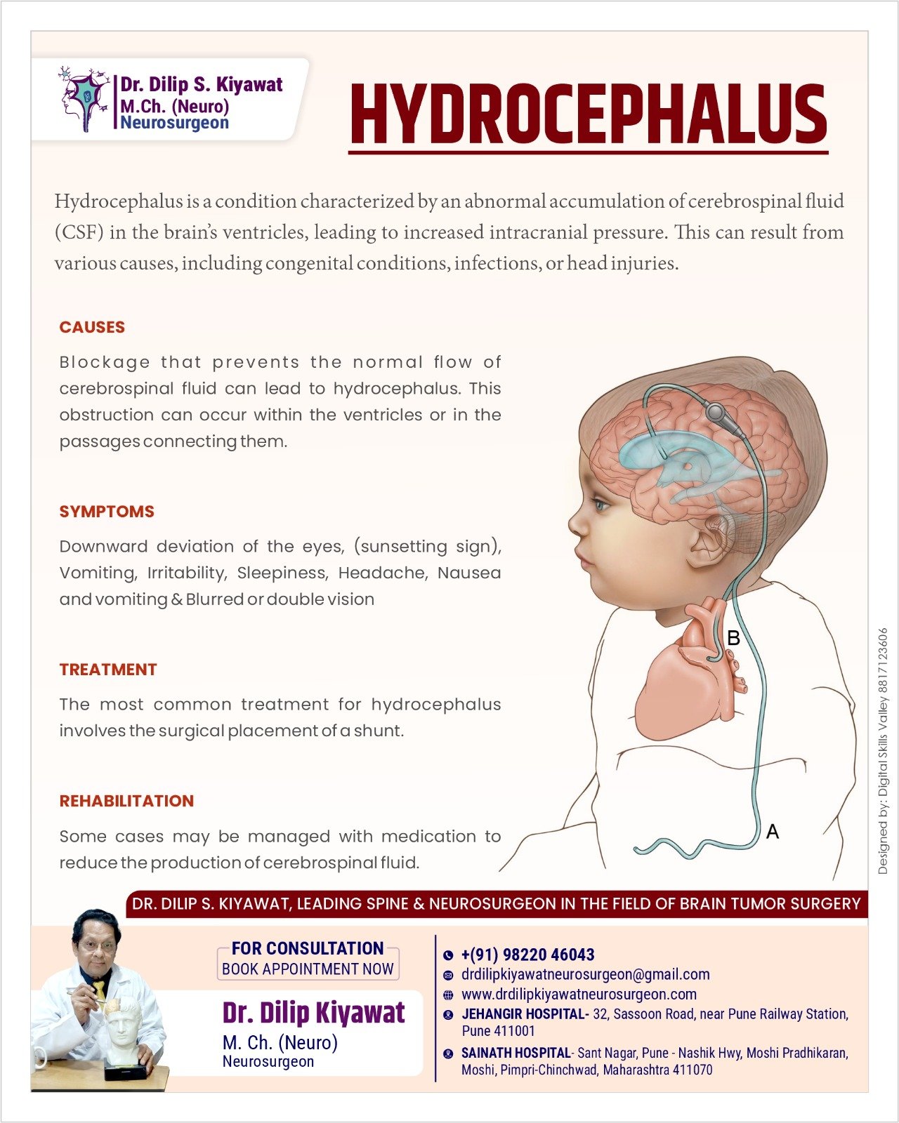 Hydrocephalus