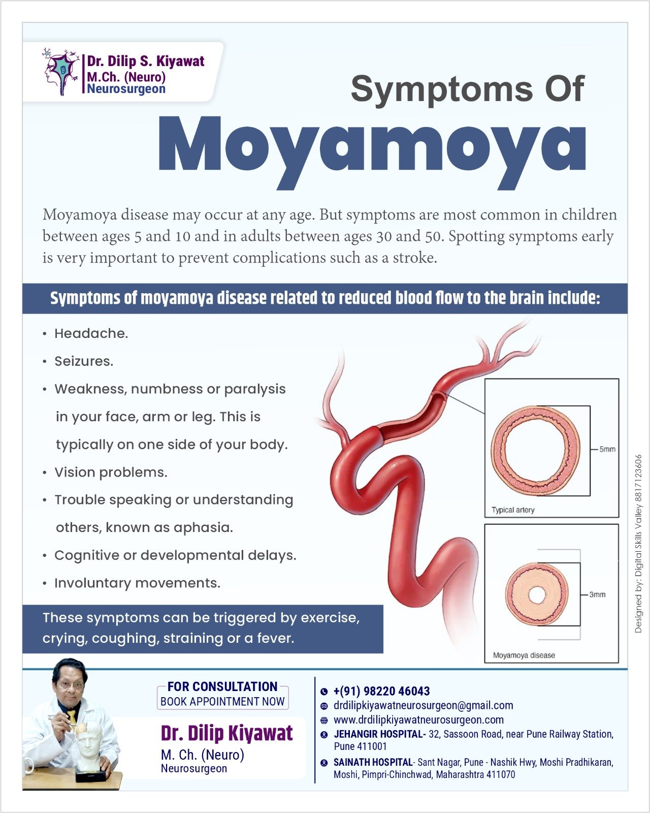 Symptoms of Moyamoya