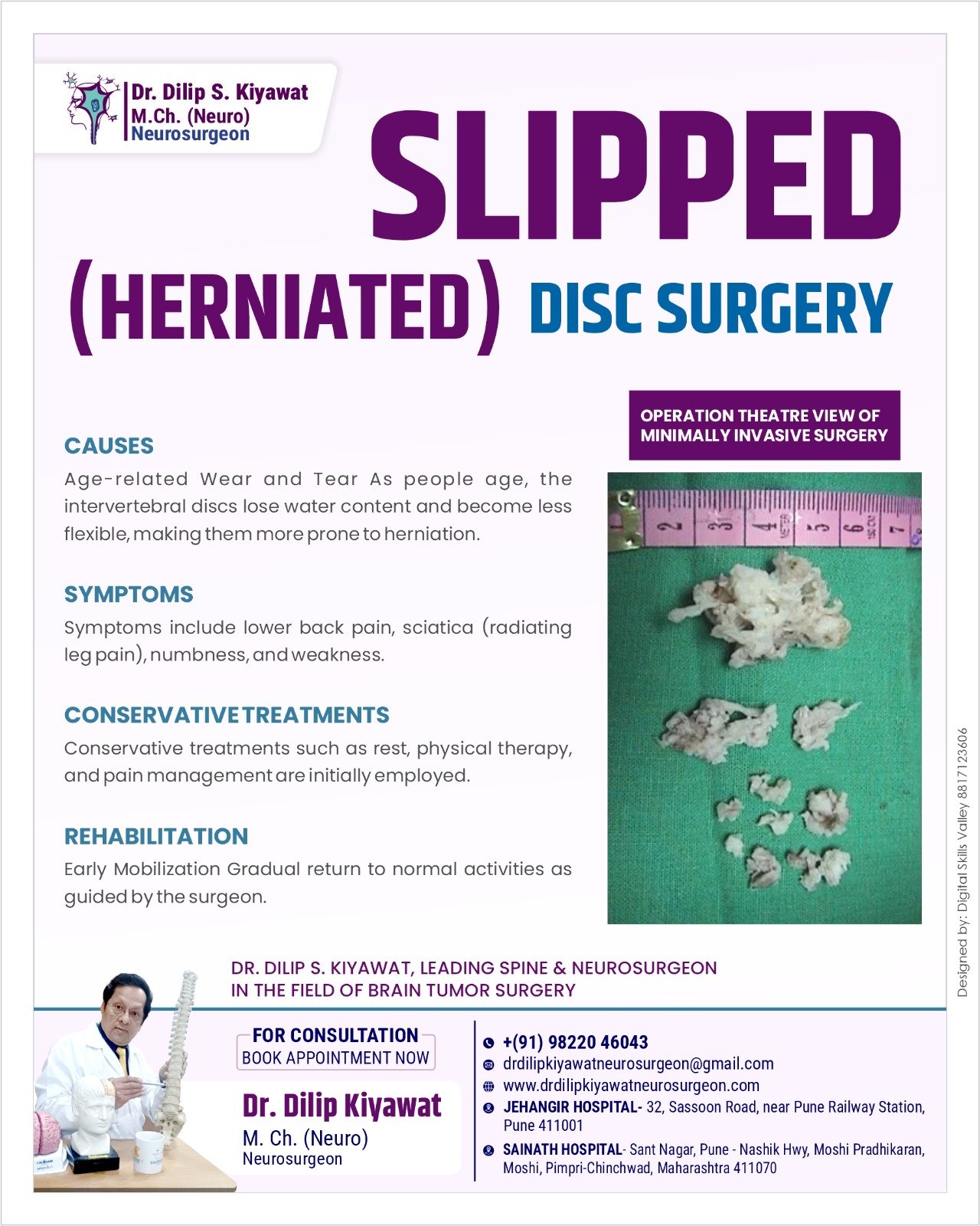 Slipped (Herniated) Disc Surgery: A Comprehensive Guide