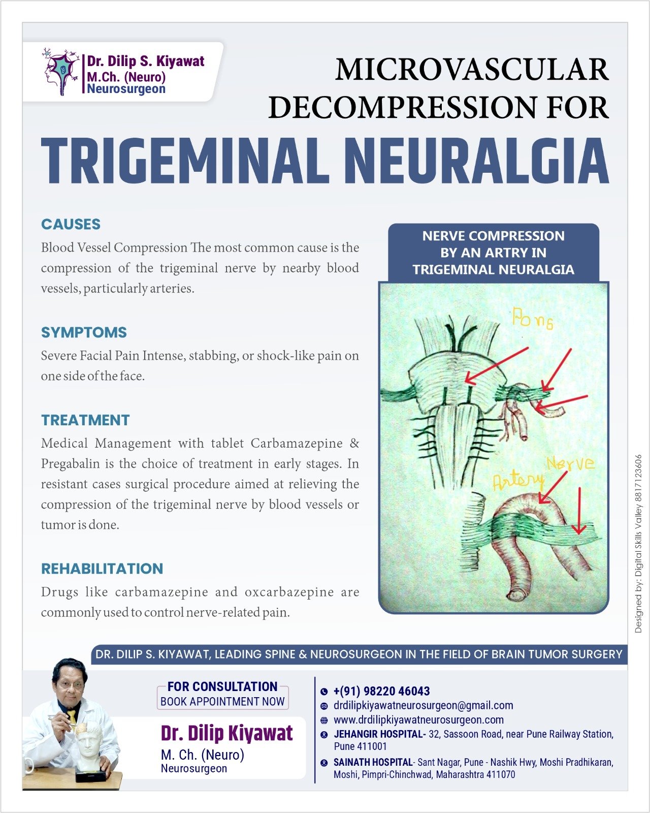 Microvascular Decompression for Trigeminal Neuralgia