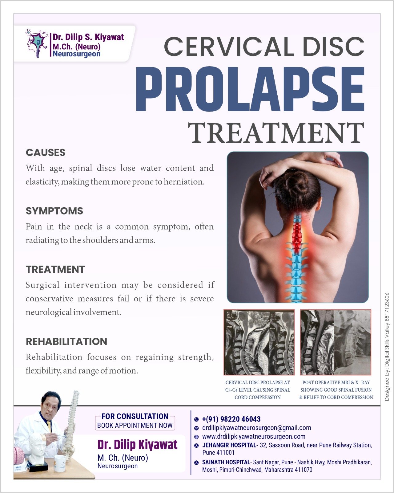 Cervical Disc Prolapse: Causes, Symptoms, and Treatment Options