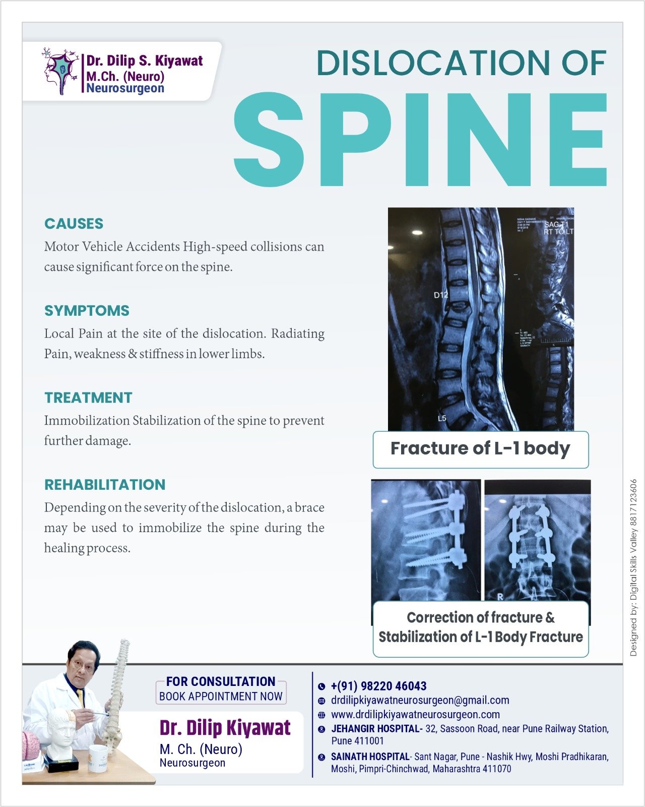 Spine Dislocation: Causes, Symptoms, Treatment, & Rehabilitation