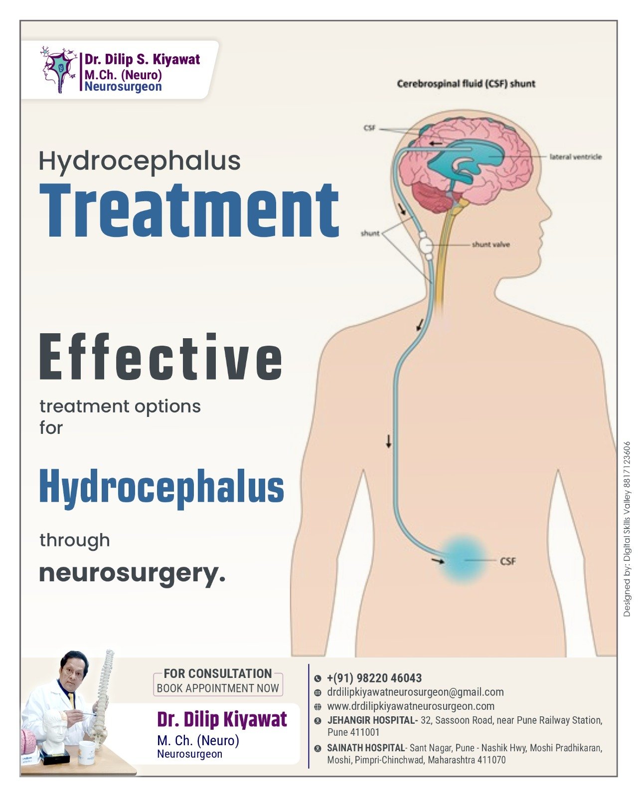 Effective Neurosurgical Treatment Options for Hydrocephalus