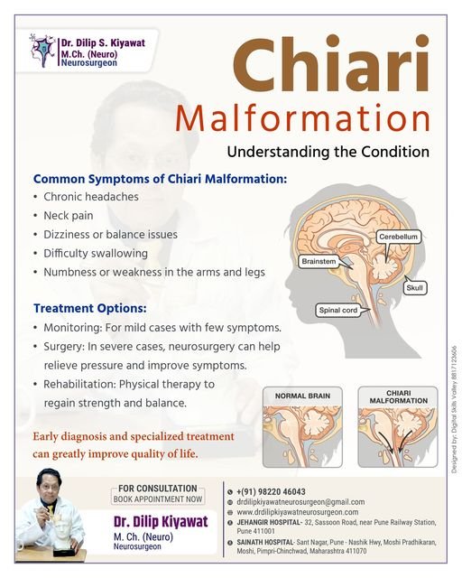 Chiari Malformation