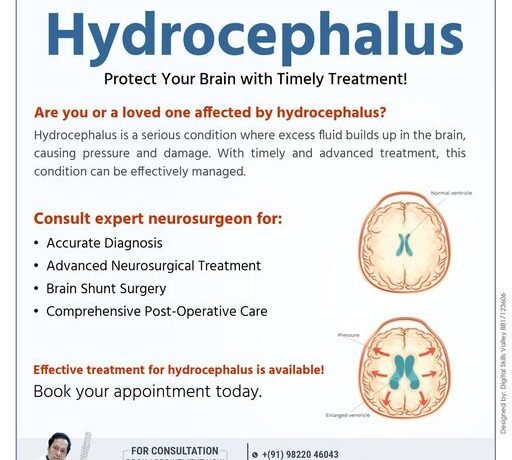 Hydrocephalus