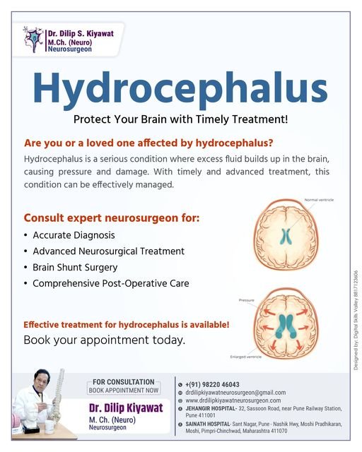 Hydrocephalus