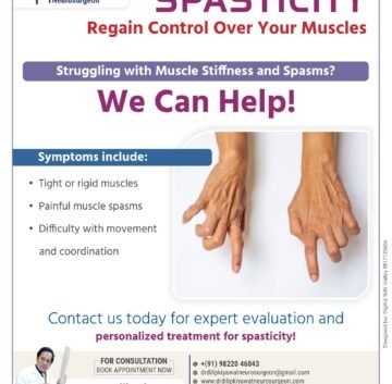 Spasticity Regain Control Over Your Muscles