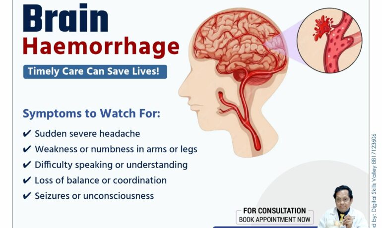 Brain Haemorrhage