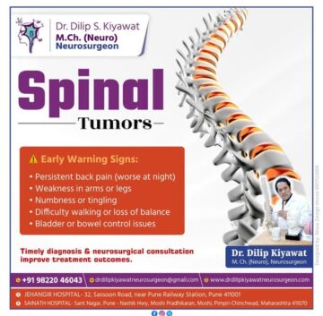 Spinal tumor treatment in Pune by Dr Dilip Kiyawat