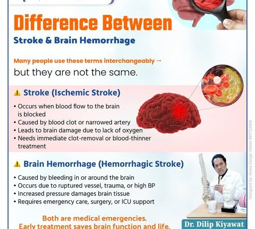Difference between Stroke and Brain Hemorrhage explained by Dr. Dilip S. Kiyawat – Best Neurosurgeon in Pune showing ischemic stroke vs hemorrhagic stroke causes, symptoms and treatment.